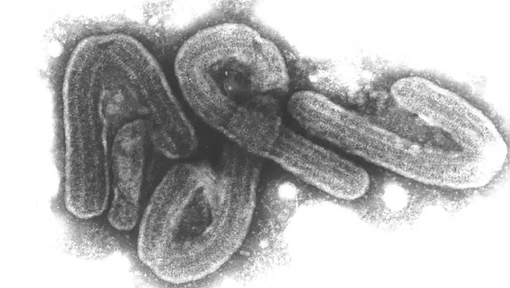 Mikroskopaufnahme des Marburg-Virus